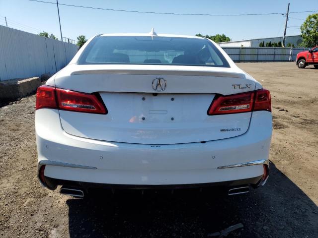 Photo 5 VIN: 19UUB3F72JA004114 - ACURA TLX ADVANC 