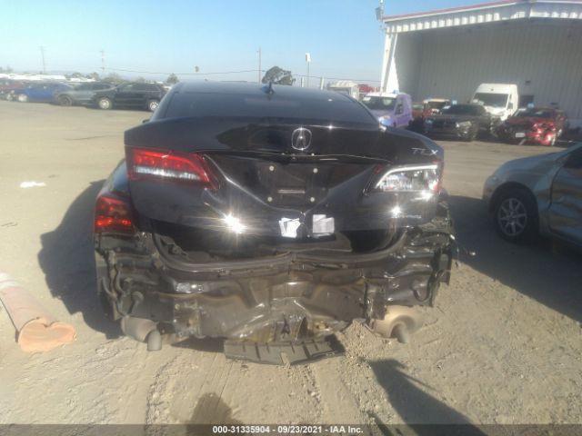 Photo 5 VIN: 19UUB3F73FA009376 - ACURA TLX 