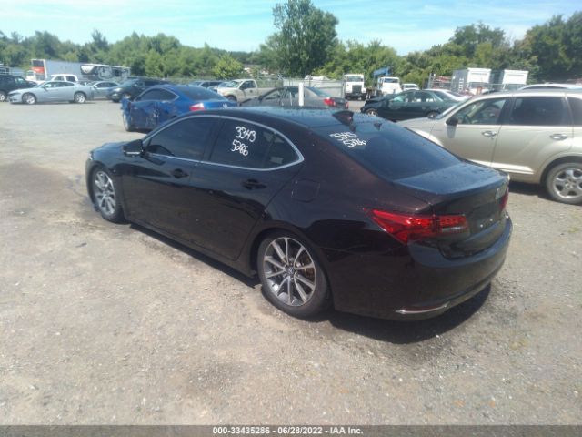 Photo 2 VIN: 19UUB3F74FA001321 - ACURA TLX 