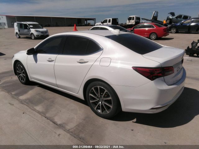 Photo 2 VIN: 19UUB3F75FA010108 - ACURA TLX 