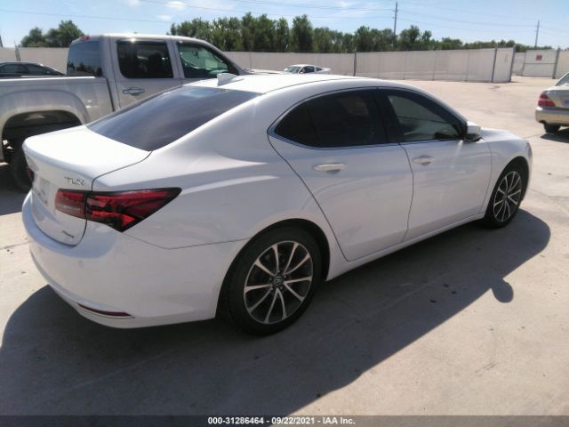 Photo 3 VIN: 19UUB3F75FA010108 - ACURA TLX 