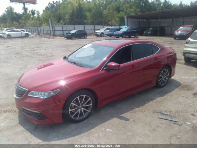 Photo 1 VIN: 19UUB3F75HA001881 - ACURA TLX 