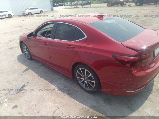 Photo 2 VIN: 19UUB3F75HA001881 - ACURA TLX 