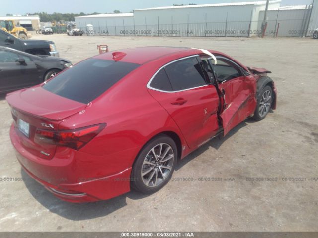 Photo 3 VIN: 19UUB3F75HA001881 - ACURA TLX 