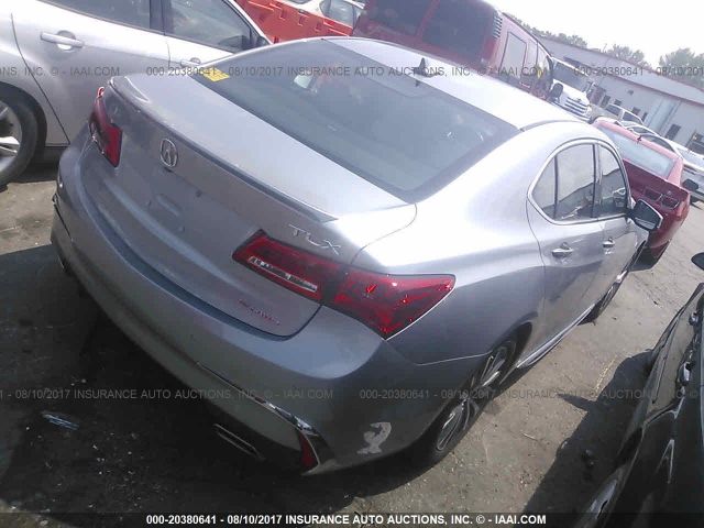 Photo 3 VIN: 19UUB3F75JA002020 - ACURA TLX 