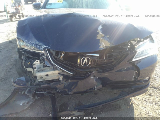 Photo 5 VIN: 19UUB3F77GA002898 - ACURA TLX 