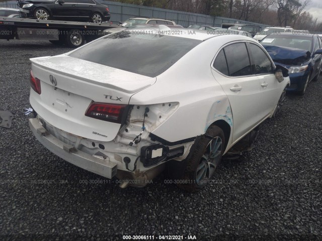 Photo 3 VIN: 19UUB3F79FA004375 - ACURA TLX 