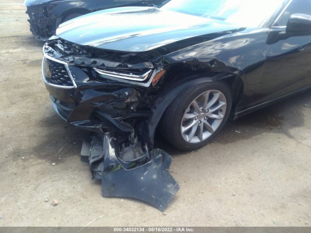 Photo 5 VIN: 19UUB5F36MA004162 - ACURA TLX 