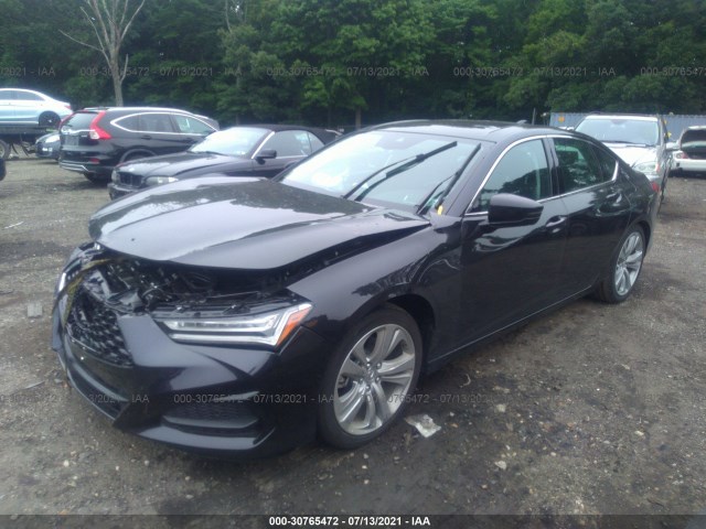 Photo 1 VIN: 19UUB5F47MA008584 - ACURA TLX 