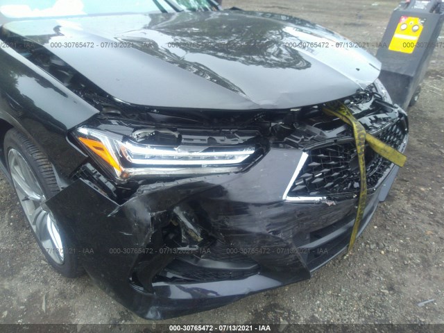 Photo 5 VIN: 19UUB5F47MA008584 - ACURA TLX 