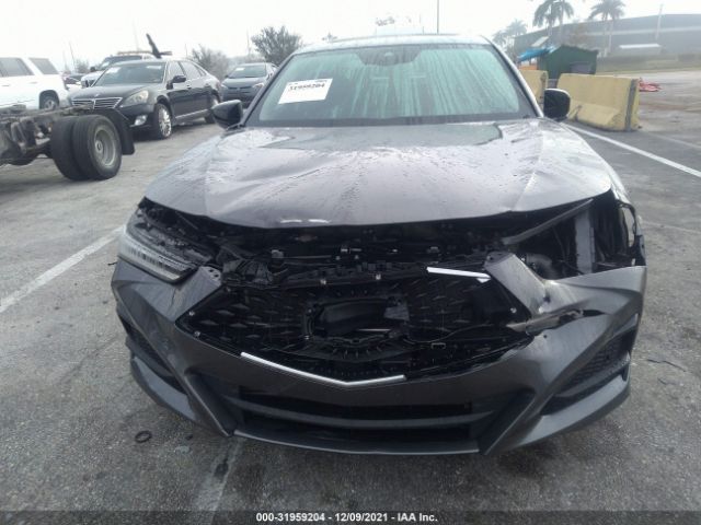 Photo 5 VIN: 19UUB5F47MA011825 - ACURA TLX 