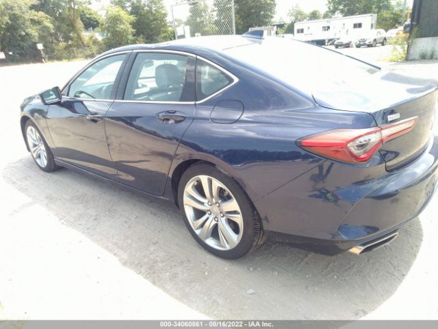 Photo 2 VIN: 19UUB5F4XMA007283 - ACURA TLX 