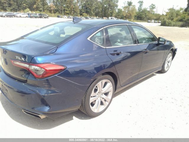 Photo 3 VIN: 19UUB5F4XMA007283 - ACURA TLX 