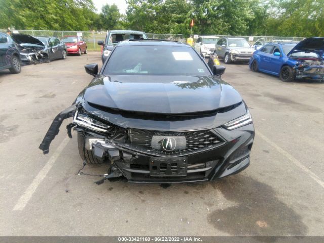 Photo 5 VIN: 19UUB5F58NA002304 - ACURA TLX 