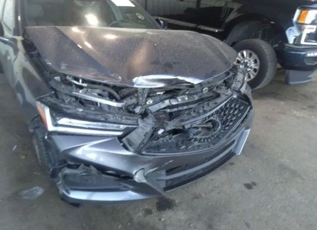 Photo 5 VIN: 19UUB5F5XNA003907 - ACURA TLX 