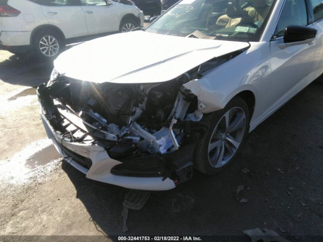 Photo 5 VIN: 19UUB5F62MA001270 - ACURA TLX 