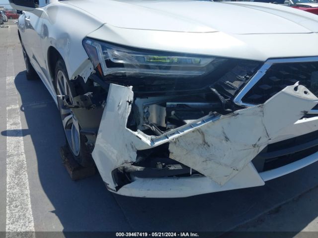 Photo 5 VIN: 19UUB5F64MA008320 - ACURA TLX 