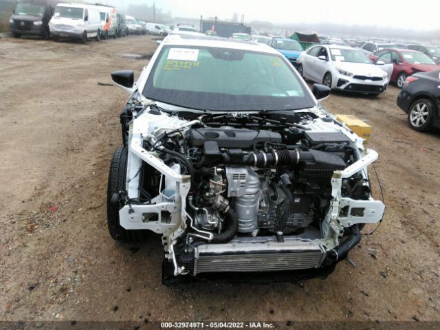 Photo 5 VIN: 19UUB6F4XMA011629 - ACURA TLX 