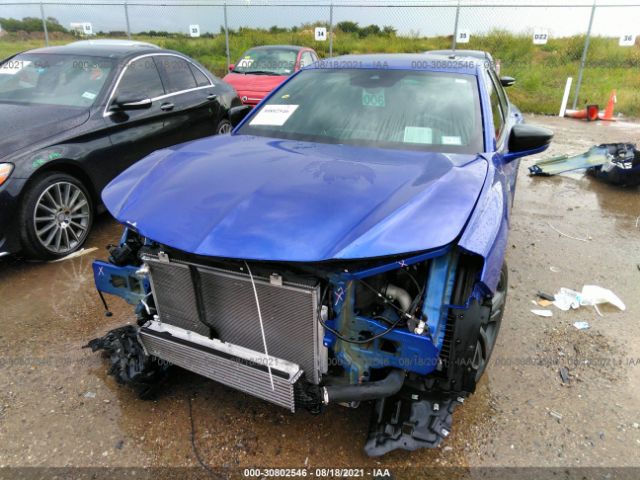 Photo 5 VIN: 19UUB6F59MA008374 - ACURA TLX 