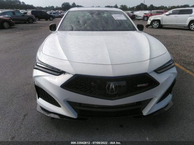 Photo 5 VIN: 19UUB7F97NA001563 - ACURA TLX 