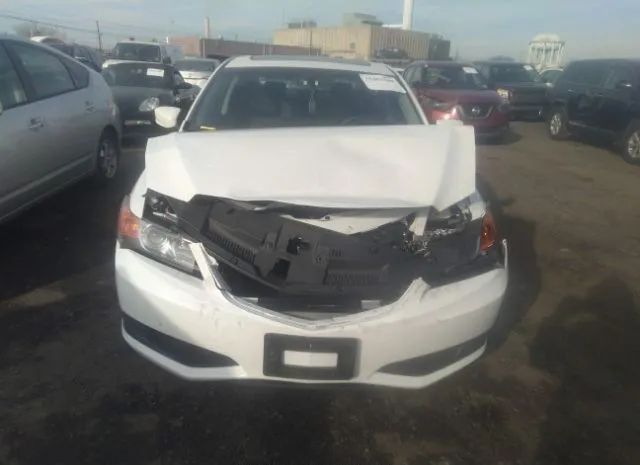 Photo 5 VIN: 19VDE1F30FE008635 - ACURA ILX 