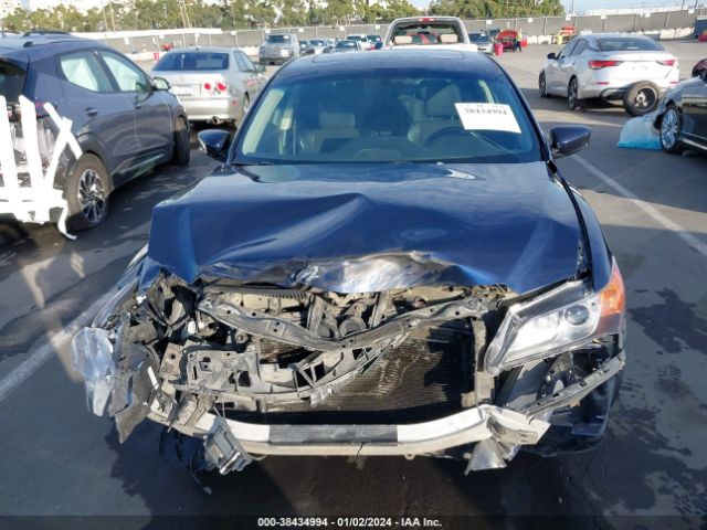 Photo 5 VIN: 19VDE1F36DE020284 - ACURA ILX 