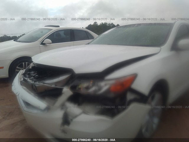 Photo 5 VIN: 19VDE1F3XFE004589 - ACURA ILX 