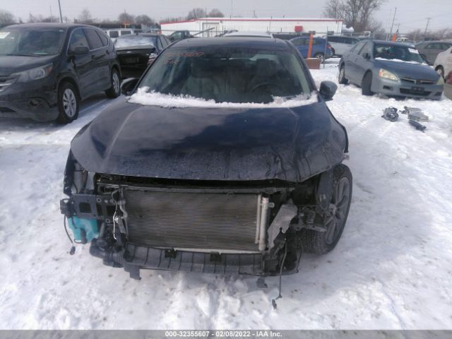 Photo 5 VIN: 19XFC1F30LE023573 - HONDA CIVIC SEDAN 