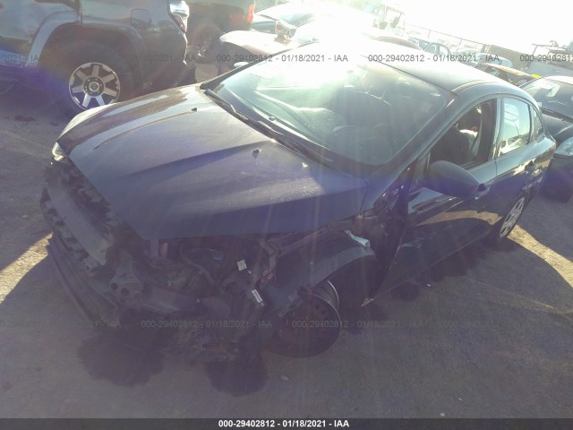 Photo 1 VIN: 1FADP3E23JL313106 - FORD FOCUS 