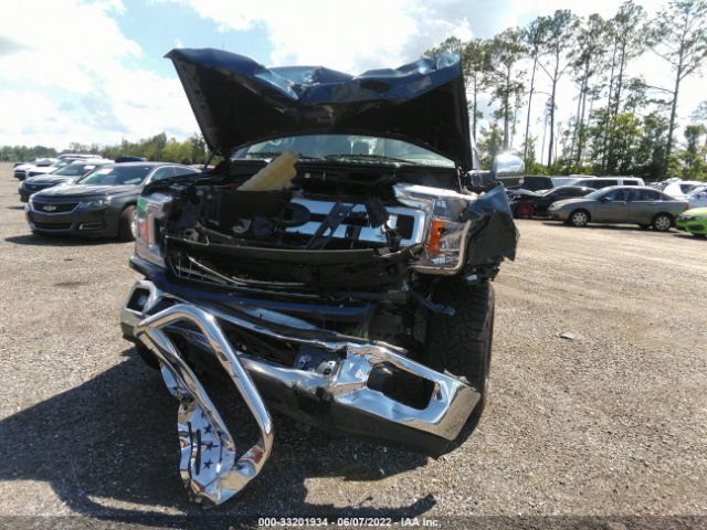 Photo 5 VIN: 1FTEW1CP1JFA05693 - FORD F-150 