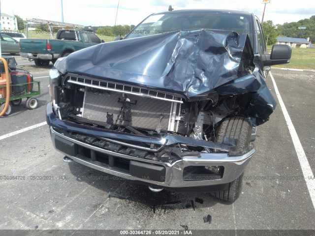 Photo 5 VIN: 1FTEW1E45LFA15908 - FORD F-150 