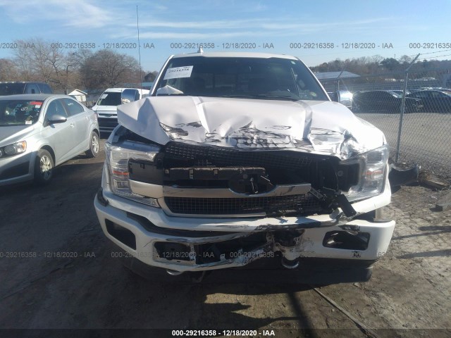 Photo 5 VIN: 1FTEW1EG4JFB20768 - FORD F-150 