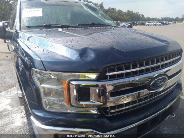 Photo 5 VIN: 1FTEW1EP0JFB68395 - FORD F-150 