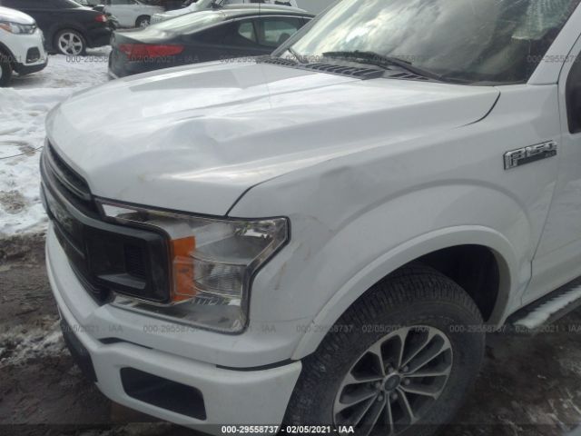 Photo 5 VIN: 1FTEW1EP5JFC28171 - FORD F-150 