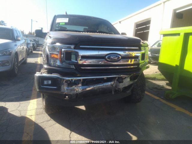 Photo 5 VIN: 1FTEW1EP6LFB21570 - FORD F-150 