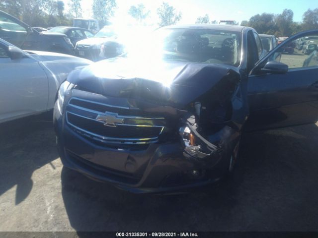 Photo 5 VIN: 1G11F5SR9DF160756 - CHEVROLET MALIBU 