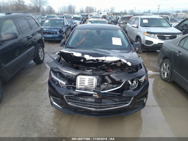 Photo 5 VIN: 1G1ZB5ST1JF285952 - CHEVROLET MALIBU 