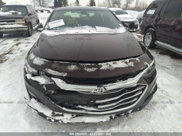 Photo 5 VIN: 1G1ZB5ST2LF118082 - CHEVROLET MALIBU 