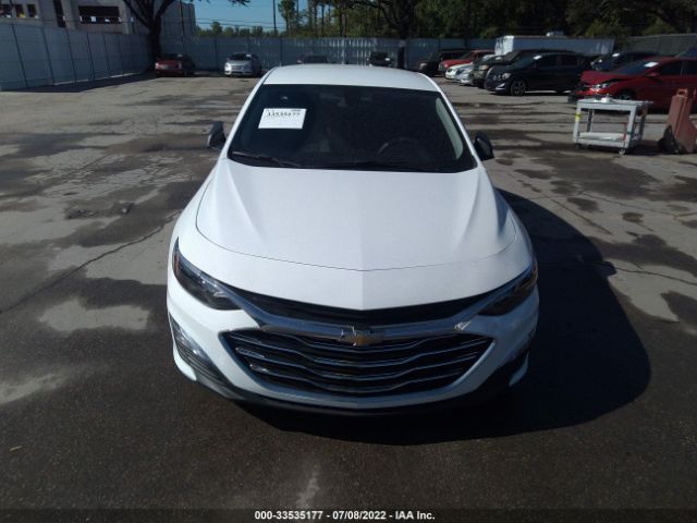 Photo 5 VIN: 1G1ZB5ST7MF016844 - CHEVROLET MALIBU 