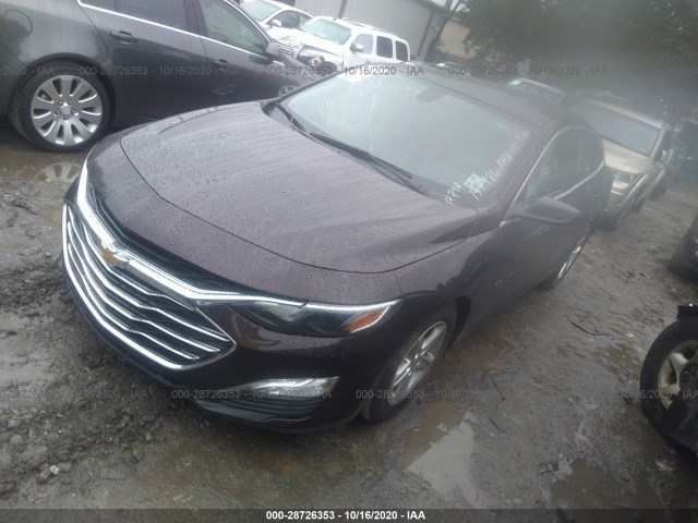 Photo 1 VIN: 1G1ZB5ST9LF142105 - CHEVROLET MALIBU 