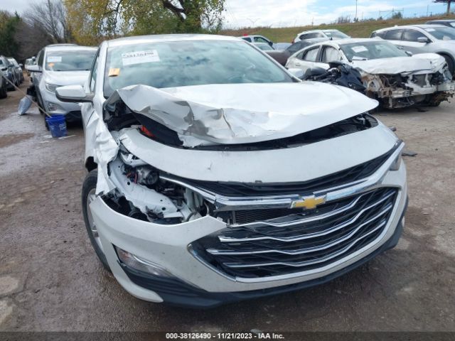 Photo 5 VIN: 1G1ZC5ST8LF144778 - CHEVROLET MALIBU 