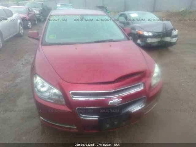 Photo 5 VIN: 1G1ZD5E7XAF124492 - CHEVROLET MALIBU 