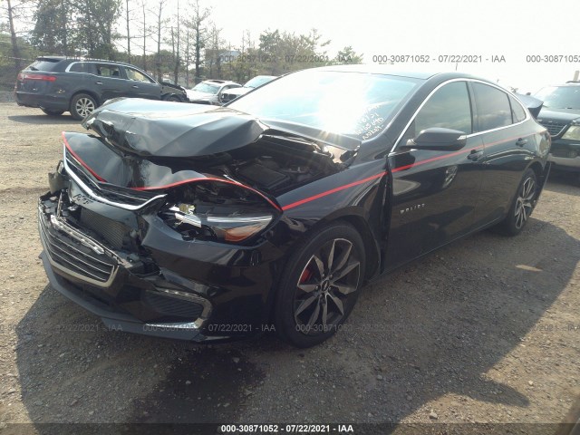 Photo 1 VIN: 1G1ZD5ST0JF203512 - CHEVROLET MALIBU 