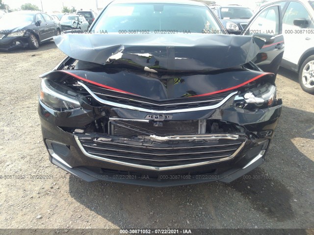 Photo 5 VIN: 1G1ZD5ST0JF203512 - CHEVROLET MALIBU 