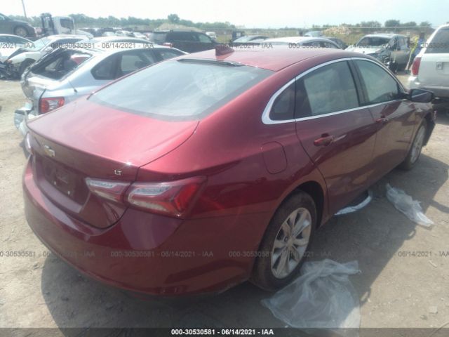 Photo 3 VIN: 1G1ZD5ST0LF004494 - CHEVROLET MALIBU 