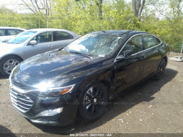 Photo 1 VIN: 1G1ZD5ST0LF014460 - CHEVROLET MALIBU 