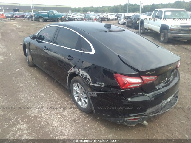 Photo 2 VIN: 1G1ZD5ST0LF018511 - CHEVROLET MALIBU 