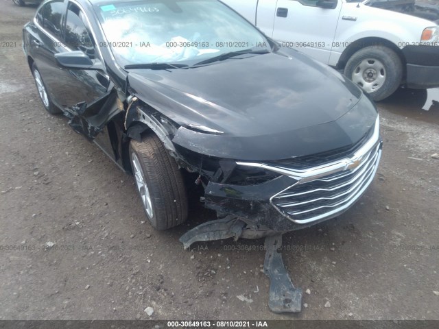 Photo 5 VIN: 1G1ZD5ST0LF018511 - CHEVROLET MALIBU 