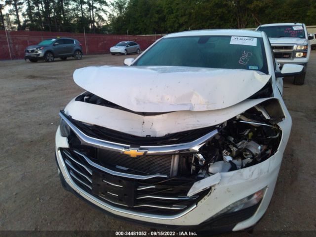 Photo 5 VIN: 1G1ZD5ST0LF044686 - CHEVROLET MALIBU 