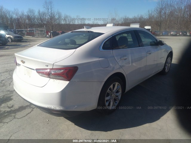 Photo 3 VIN: 1G1ZD5ST0LF074383 - CHEVROLET MALIBU 